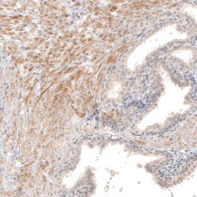 Immunohistochemistry-Paraffin: B7-H6 Antibody [NBP1-91144] - Staining of human prostate shows weak to moderate cytoplasmic positivity in smooth muscle cells.