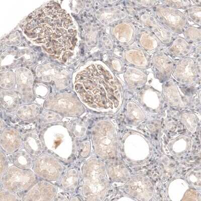 Immunohistochemistry-Paraffin: B7-H6 Antibody [NBP1-91144] - Staining of human kidney shows weak membranous positivity in cells in glomeruli.