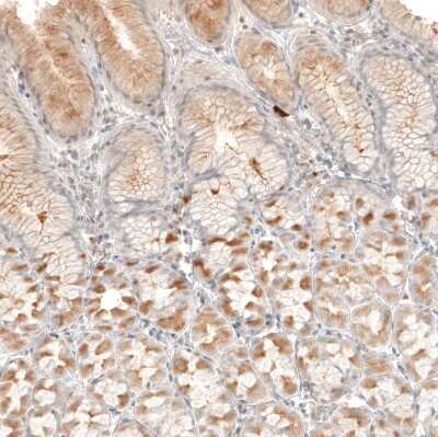 Immunohistochemistry-Paraffin: B7-H6 Antibody [NBP1-91144] - Staining of human stomach shows weak to moderate membranous and cytoplasmic positivity in glandular cells.