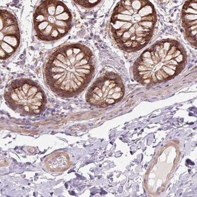 Immunohistochemistry-Paraffin: B7-H7/HHLA2 Antibody [NBP2-49187] - Staining of human colon shows strong  granular cytoplasmic positivity in glandular cells.