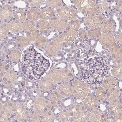 Immunohistochemistry-Paraffin: B7-H7/HHLA2 Antibody [NBP2-49187] - Staining of human kidney shows weak cytoplasmic positivity in cells in tubules.