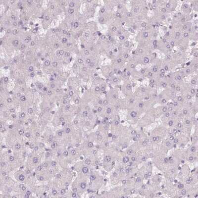 Immunohistochemistry-Paraffin: B7-H7/HHLA2 Antibody [NBP2-49187] - Staining of human liver shows no positivity in hepatocytes as expected.