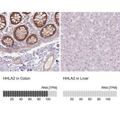 Immunohistochemistry-Paraffin: B7-H7/HHLA2 Antibody [NBP2-49187] - Analysis in human colon and liver tissues using NBP2-49187 antibody. Corresponding B7-H7/HHLA2 RNA-seq data are presented for the same tissues.