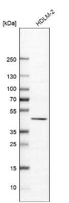 <b>Orthogonal Strategies Validation. </b>Western Blot: B7-H7/HHLA2 Antibody [NBP2-49187] - Analysis in human cell line HDLM-2.