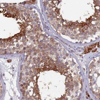 Immunohistochemistry-Paraffin: B9D2 Antibody [NBP1-91694] - Staining of human testis shows strong cytoplasmic positivity in cells in seminiferus ducts and Leydig cells.