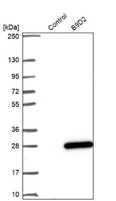 Western Blot: B9D2 Antibody [NBP1-91693] - Analysis in control (vector only transfected HEK293T lysate) and B9D2 over-expression lysate (Co-expressed with a C-terminal myc-DDK tag (3.1 kDa) in mammalian HEK293T cells).