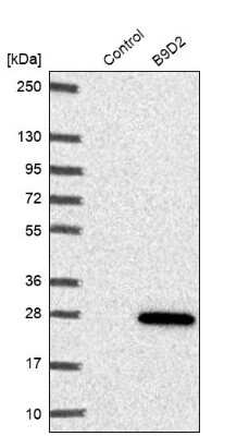 Western Blot: B9D2 Antibody [NBP1-91694] - Analysis in control (vector only transfected HEK293T lysate) and B9D2 over-expression lysate (Co-expressed with a C-terminal myc-DDK tag (3.1 kDa) in mammalian HEK293T cells).