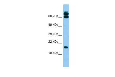 Western Blot: B9D2 Antibody [NBP2-84490] - Host: Rabbit. Target Name: B9D2. Sample Type: Fetal Brain lysates. Antibody Dilution: 1.0ug/ml