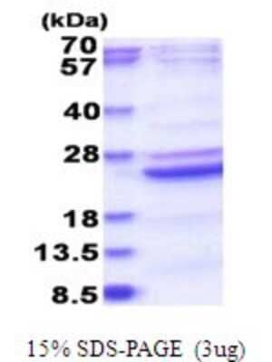 SDS-Page: B9D2 Recombinant Protein [NBP2-51780] - 15% SDS Page (3 ug)