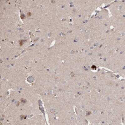 Immunohistochemistry-Paraffin BAAT1 Antibody