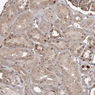 Immunohistochemistry-Paraffin BAAT1 Antibody