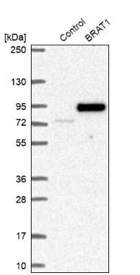 Western Blot BAAT1 Antibody