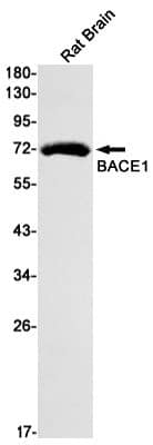 Western Blot: BACE-1 Antibody (S03-9C8) [NBP3-19577] - Western blot detection of BACE-1 in Rat Brain lysates using NBP3-19577 (1:1000 diluted). Predicted band size: 56kDa. Observed band size: 70kDa.