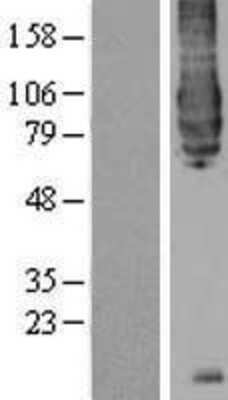 Western Blot BACE-1 Overexpression Lysate