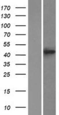 Western Blot: BACE2 Overexpression Lysate (Adult Normal) [NBP2-05612] Left-Empty vector transfected control cell lysate (HEK293 cell lysate); Right -Over-expression Lysate for BACE2.