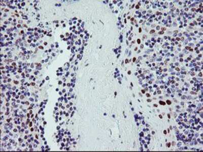 Immunohistochemistry-Paraffin: BACH1 Antibody (4E11) [NBP2-01904] Staining of paraffin-embedded Human tonsil using anti-BACH1 mouse monoclonal antibody.