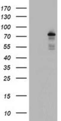 Western Blot: BACH1 Antibody (4E11) [NBP2-01904] - HEK293T cells were transfected with the pCMV6-ENTRY control (Left lane) or pCMV6-ENTRY BACH1 (Right lane) cDNA for 48 hrs and lysed. Equivalent amounts of cell lysates (5 ug per lane) were separated by SDS-PAGE and immunoblotted with anti-BACH1.