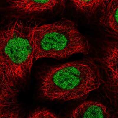 Immunocytochemistry/Immunofluorescence: BACH1 Antibody [NBP2-55113] - Staining of human cell line A-431 shows localization to nucleoplasm. Antibody staining is shown in green.