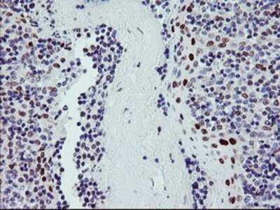 Immunohistochemistry: BACH1 Antibody (OTI4E11) - Azide and BSA Free [NBP2-70240] - Staining of paraffin-embedded Human tonsil using anti-BACH1 mouse monoclonal antibody.