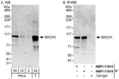 Western Blot: BACH1 Antibody [NBP1-71814] - Whole cell lysate from HeLa (5, 15 and 50 mcg for WB; 1 mg for IP, 20% of IP loaded) and 293T (T; 50 mcg) cells. Affinity purified rabbit anti-BACH1 antibody used for WB at 0.1 mcg/ml (A) and 1 mcg/ml (B) and used for IP at 6 mcg/mg lysate.  BACH1 was also immunoprecipitated by rabbit anti-BACH1 antibody NBP1-71815 which recognizes a downstream epitope.