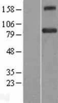 Western Blot: BACH1 Overexpression Lysate (Adult Normal) [NBL1-07898] Left-Empty vector transfected control cell lysate (HEK293 cell lysate); Right -Over-expression Lysate for BACH1.