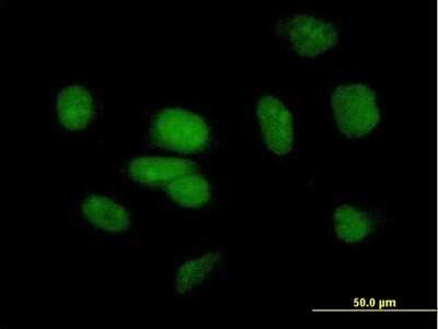 Immunocytochemistry/Immunofluorescence: BAF180/PB1 Antibody [H00055193-B02P] - Analysis of purified antibody to PB1 on HeLa cell. (antibody concentration 10 ug/ml)