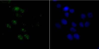 Immunocytochemistry/Immunofluorescence: BAF53A Antibody (JU40-32) [NBP2-75415] - Staining ACTL6A in LOVO cells (green). The nuclear counter stain is DAPI (blue). Cells were fixed in paraformaldehyde, permeabilised with 0.25% Triton X100/PBS.