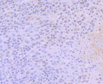 Immunohistochemistry-Paraffin: BAF53A Antibody (JU40-32) [NBP2-75415] - Analysis of paraffin-embedded human tonsil tissue using anti-ACTL6A antibody. Counter stained with hematoxylin.