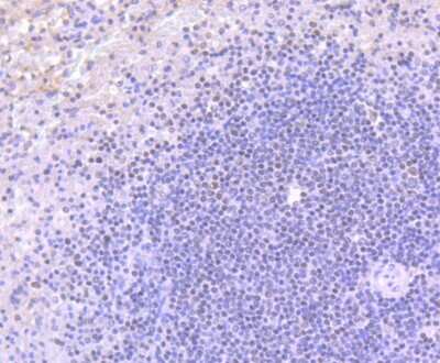Immunohistochemistry-Paraffin: BAF53A Antibody (JU40-32) [NBP2-75415] - Analysis of paraffin-embedded human spleen tissue using anti-ACTL6A antibody. Counter stained with hematoxylin.