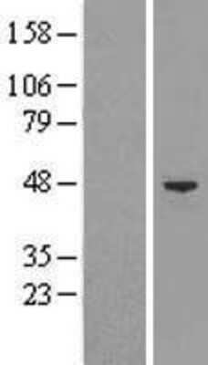 Western Blot: BAF53A Overexpression Lysate (Adult Normal) [NBL1-07277] Left-Empty vector transfected control cell lysate (HEK293 cell lysate); Right -Over-expression Lysate for BAF53A.