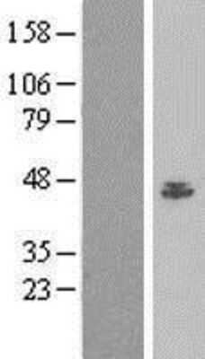 Western Blot: BAF53A Overexpression Lysate (Adult Normal) [NBP2-04995] Left-Empty vector transfected control cell lysate (HEK293 cell lysate); Right -Over-expression Lysate for BAF53A.