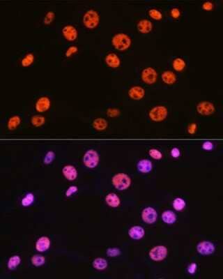 Immunocytochemistry/Immunofluorescence: BAF57 Antibody (9L5F6) [NBP3-16279] - Immunofluorescence analysis of NIH-3T3 cells using BAF57 Rabbit mAb (NBP3-16279) at dilution of 1:100 (40x lens). Blue: DAPI for nuclear staining.