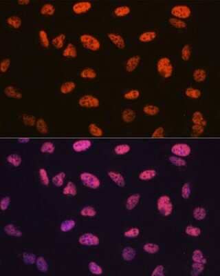 Immunocytochemistry/Immunofluorescence: BAF57 Antibody (9L5F6) [NBP3-16279] - Immunofluorescence analysis of U-2 OS cells using BAF57 Rabbit mAb (NBP3-16279) at dilution of 1:100 (40x lens). Blue: DAPI for nuclear staining.