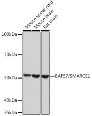 Western Blot: BAF57 Antibody (9L5F6) [NBP3-16279] - Western blot analysis of extracts of various cell lines, using BAF57 Rabbit mAb (NBP3-16279) at 1:1000 dilution. Secondary antibody: HRP Goat Anti-Rabbit IgG (H+L) at 1:10000 dilution. Lysates/proteins: 25ug per lane. Blocking buffer: 3% nonfat dry milk in TBST. Detection: ECL Basic Kit. Exposure time: 30s.