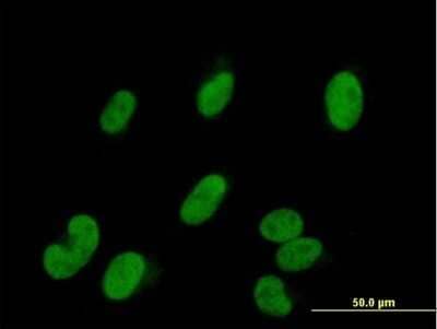 Immunocytochemistry/Immunofluorescence: BAF57 Antibody [H00006605-B01P] - Analysis of purified antibody to SMARCE1 on HepG2 cell. (antibody concentration 10 ug/ml)