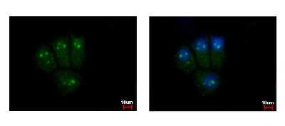 Immunocytochemistry/Immunofluorescence: BAF57 Antibody [NBP2-15540] - BAF57 antibody detects SMARCE1 protein at nucleus by immunofluorescent analysis. Sample: MCF-7 cells were fixed in 4% paraformaldehyde at RT for 15 min. Green: SMARCE1 protein stained by BAF57 antibody diluted at 1:500. Blue: Hoechst 33343 staining.
