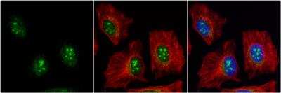 Immunocytochemistry/Immunofluorescence: BAF57 Antibody [NBP2-15540] - BAF57 antibody detects BAF57 protein at nucleus by immunofluorescent analysis. Sample: HeLa cells were fixed in 4% paraformaldehyde at RT for 15 min. Green: BAF57 protein stained by BAF57 antibody diluted at 1:1000. Red: alpha Tubulin, a cytoskeleton marker, stained by alpha Tubulin antibody diluted at 1:500. Blue: Hoechst 33342 staining.