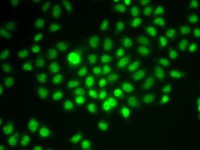 <b>Genetic Strategies Validation. </b>Immunocytochemistry/Immunofluorescence: BAF57 Antibody [NBP2-92966] - Analysis of HeLa cells using BAF57 .