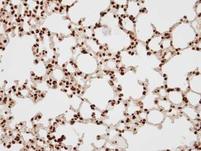 Immunohistochemistry-Paraffin: BAF57 Antibody [NBP1-31100] - Paraffin-embedded lung, using antibody at 1:100 dilution.