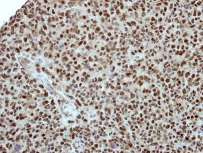Immunohistochemistry-Paraffin: BAF57 Antibody [NBP2-15540] - Immunohistochemical analysis of paraffin-embedded H1299 xenograft, using antibody at 1:500 dilution.