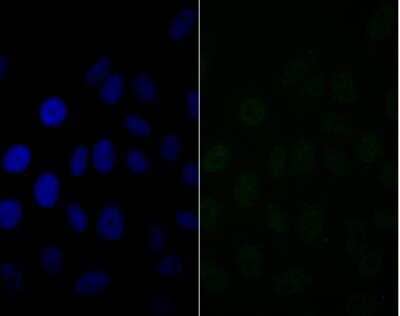Immunocytochemistry/Immunofluorescence: BAF57 Antibody (JE41-11) [NBP2-76977] - ICC staining BAF57 in HepG2 cells (green). The nuclear counter stain is DAPI (blue). Cells were fixed in paraformaldehyde, permeabilised with 0.25% Triton X100/PBS.