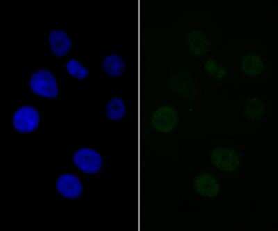 Immunocytochemistry/Immunofluorescence: BAF57 Antibody (JE41-11) [NBP2-76977] - ICC staining BAF57 in SK-Br-3 cells (green). The nuclear counter stain is DAPI (blue). Cells were fixed in paraformaldehyde, permeabilised with 0.25% Triton X100/PBS.