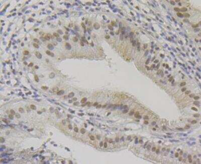 Immunohistochemistry: BAF57 Antibody (JE41-11) [NBP2-76977] - Immunohistochemical analysis of paraffin-embedded human gallbladder tissue using anti-BAF57 antibody. Counter stained with hematoxylin.