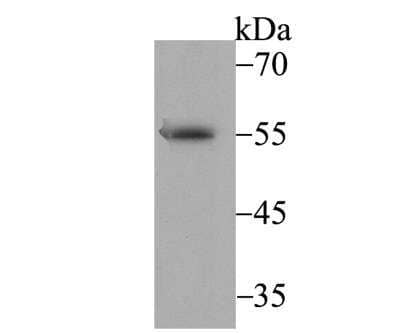 Western Blot: BAF57 Antibody (JE41-11) [NBP2-76977] - Western blot analysis of BAF57 on SH-SY-5Y cell lysate using anti-BAF57 antibody at 1/1,000 dilution.
