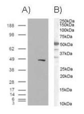 Western Blot: BAF57 Antibody [NB100-1297] - A) HEK293 overexpressing BAF57 and probed with (mock transfection in first lane). B) see Western Blot.