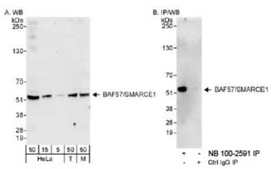 Western Blot: BAF57 Antibody [NB100-2591] - Detection of Human and Mouse BAF57/SMARCE1 on HeLa whole cell lysates using NB100-2591.