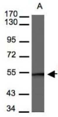 Western Blot: BAF57 Antibody [NBP1-31100] - Raji 7.5% SDS PAGE; antibody diluted at 1:3000