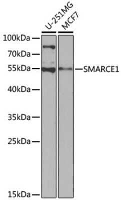 Western Blot: BAF57 Antibody [NBP2-92966] - Analysis of extracts of various cell lines, using BAF57 at 1:1000 dilution. Secondary antibody: HRP Goat Anti-Rabbit IgG (H+L) at 1:10000 dilution. Lysates/proteins: 25ug per lane. Blocking buffer: 3% nonfat dry milk in TBST. Detection: ECL Basic Kit . Exposure time: 90s.