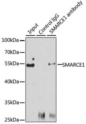 Western Blot: BAF57 Antibody [NBP2-92966] - Analysis of 150ug extracts of Jurkat cells using BAF57 antibody . Western blot was performed from the immunoprecipitate using this antibody