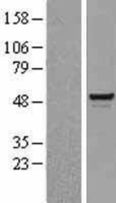 Western Blot: BAF57 Overexpression Lysate (Adult Normal) [NBL1-16235] Left-Empty vector transfected control cell lysate (HEK293 cell lysate); Right -Over-expression Lysate for BAF57.